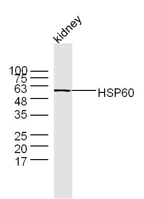 Mouse kidney lysates probed with Rabbit Anti-HSP60 Polyclonal Antibody (bs-0191R) at 1:300 overnight at 4˚C. Followed by a conjugated secondary antibody (bs-0295G-HRP ) at 1:5000 for 90 min at 37˚C.