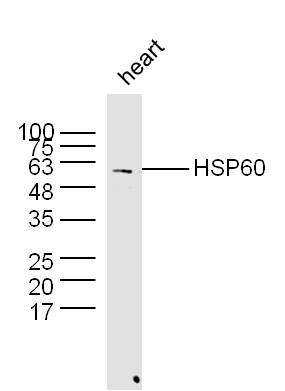 Mouse heart lysates probed with Rabbit Anti-HSP60 Polyclonal Antibody (bs-0191R) at 1:300 overnight at 4˚C. Followed by a conjugated secondary antibody (bs-0295G-HRP ) at 1:5000 for 90 min at 37˚C.