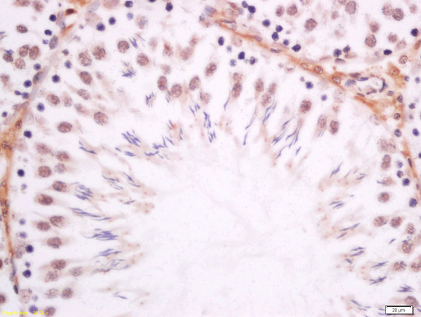 Paraformaldehyde-fixed, paraffin embedded rat testis tissue; Antigen retrieval by boiling in sodium citrate buffer(pH6) for 15min; Block endogenous peroxidase by 3% hydrogen peroxide for 30 minutes; Blocking buffer (normal goat serum) at 37°C for 20min; Antibody incubation with Rabbit Anti-DMO/Dmrt1a Polyclonal Antibody, Unconjugated (bs-11276R) at 1:200 overnight at 4°C, followed by a conjugated secondary and DAB staining