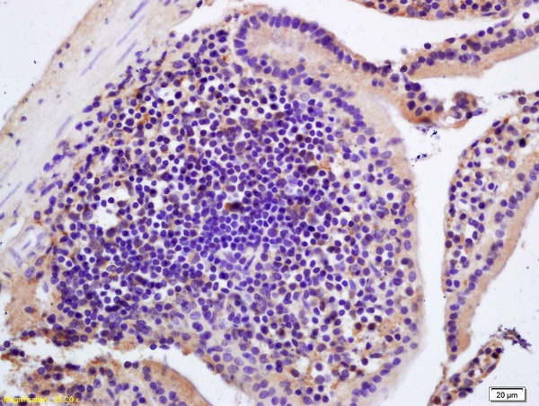 Formalin-fixed and paraffin embedded mouse intestine labeled with Rabbit Anti CIDEB Polyclonal Antibody, Unconjugated (bs-0716R) at 1:200 followed by conjugation to the secondary antibody and DAB staining