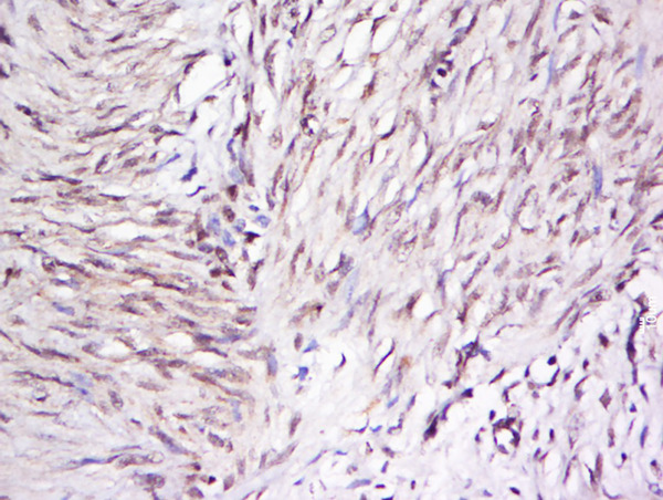 Formalin-fixed and paraffin embedded rat brain labeled with Anti-OTUD5 Polyclonal Antibody, Unconjugated (bs-17566R) at 1:500 followed by conjugation to the secondary antibody and DAB staining.