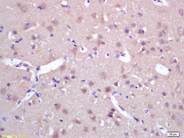 Formalin-fixed and paraffin embedded rat brain labeled with Rabbit Anti SPAG5/MAP126/Astrin Polyclonal Antibody, Unconjugated (bs-0717R) at 1:200 followed by conjugation to the secondary antibody and DAB staining