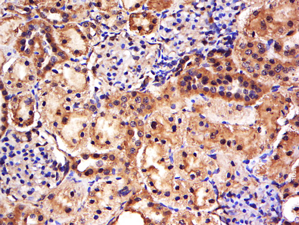 Formalin-fixed and paraffin embedded rat kidney labeled with Anti-FAM171A1 Polyclonal Antibody, Unconjugated (bs-14757R) at 1:500 followed by conjugation to the secondary antibody and DAB staining.
