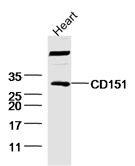 Mouse heart lysates probed with Rabbit Anti-CD151 Polyclonal Antibody, Unconjugated (bs-2524R) at 1:300 overnight at 4˚C. Followed by a conjugated secondary antibody at 1:5000 for 90 min at 37˚C