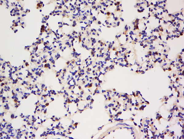 Formalin-fixed and paraffin embedded rat lung tissue labeled with Anti-IGBP1 Polyclonal Antibody, Unconjugated (bs-0298R) at 1:200 followed by conjugation to the secondary antibody and DAB staining.