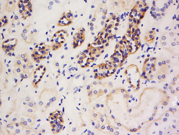 Formalin-fixed and paraffin embedded human kidney labeled with Anti-PDK4 Polyclonal Antibody, Unconjugated (bs-0682R) at 1:200 followed by conjugation to the secondary antibody and DAB staining.