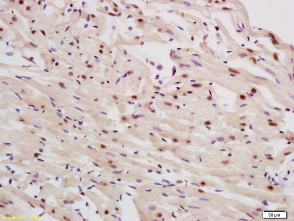 Formalin-fixed and paraffin embedded rat heart labeled with Rabbit Anti P63 protein/P51A Polyclonal Antibody, Unconjugated (bs-0723R) at 1:200 followed by conjugation to the secondary antibody and DAB staining