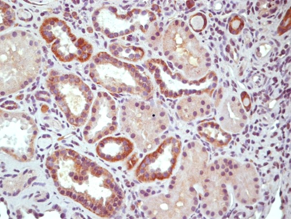This image was kindly submitted by Horea Rus of the University of Maryland.\nParaffin embedded Human kidney tissue; Stained with Rabbit Anti-RGC-32 Polyclonal Antibody, Unconjugated (bs-9079R) at 1:200 dilution followed by the RTU Vectastain kit from Vector.