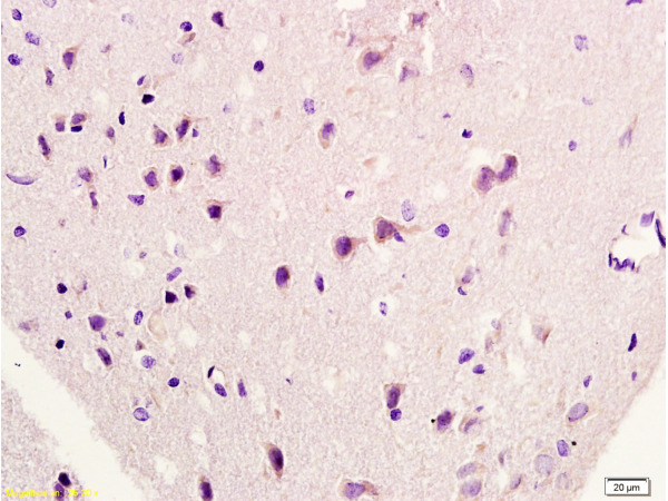 Formalin-fixed and paraffin embedded rat brain labeled with Rabbit Anti-HSP27/HspB1/HSP25 Polyclonal Antibody, Unconjugated (bs-0730R) at 1:200 followed by conjugation to the secondary antibody and DAB staining.