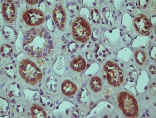 This image was kindly submitted by Horea Rus of the University of Maryland.\nParaffin embedded Human kidney tissue; Stained with Rabbit Anti-RGC-32 Polyclonal Antibody, Unconjugated (bs-9079R) at 1:200 dilution followed by the RTU Vectastain kit from Vector.