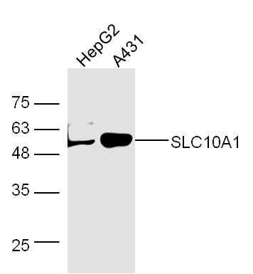 Human HepG2 and A431 lysates probed with Rabbit Anti-SLC10A1 Polyclonal Antibody, Unconjugated (bs-1958R) at 1:300 overnight at 4˚C. Followed by a conjugated secondary antibody (bs-0295G-HRP) at 1:5000 for 90 min at 37˚C.