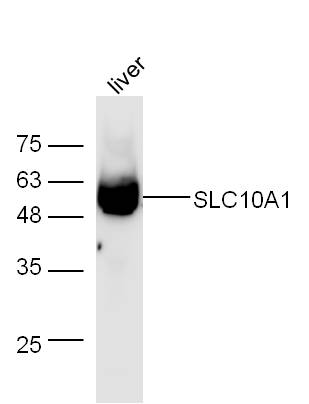 Mouse liver lysates probed with Rabbit Anti-SLC10A1 Polyclonal Antibody, Unconjugated (bs-1958R) at 1:300 overnight at 4˚C. Followed by a conjugated secondary antibody (bs-0295G-HRP) at 1:5000 for 90 min at 37˚C.