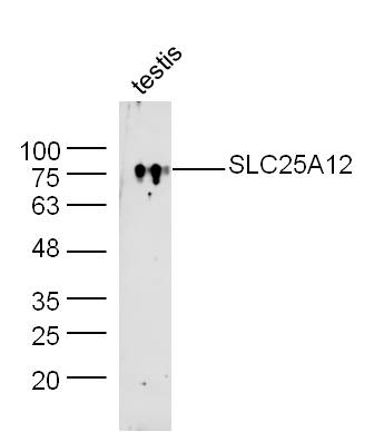 Mouse testis lysate probed with Rabbit Anti-SLC25A12/ARALAR Polyclonal Antibody, Unconjugated (bs-11953R) at 1:300 overnight at 4˚C. Followed by a conjugated secondary antibody for 90 min at 37˚C.