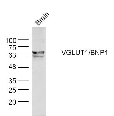 Mouse brain lysates probed with Rabbit Anti-VGLUT1 Polyclonal Antibody, Unconjugated (bs-11167R) at 1:300 overnight at 4˚C. Followed by a conjugated secondary antibody for 90 min at 37˚C.