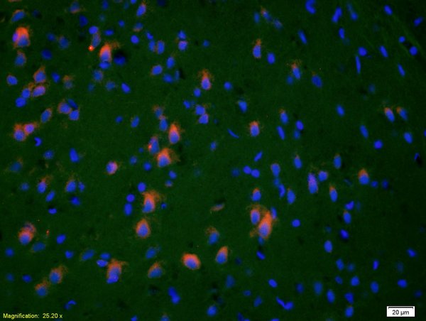 Formalin-fixed and paraffin-embedded rat brain labeled with Anti-HSP27\/HspB1\/HSP25 Polyclonal Antibody, Unconjugated(bs-0730R) 1:200, overnight at 4\u00b0C, The secondary antibody was Goat Anti-Rabbit IgG, Cy3 conjugated(bs-0295G-Cy3)used at 1:200 dilution for 40 minutes at 37\u00b0C.