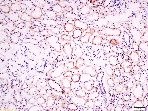 Paraformaldehyde-fixed, paraffin embedded human kidney tissue; Antigen retrieval by boiling in sodium citrate buffer(pH6) for 15min; Block endogenous peroxidase by 3% hydrogen peroxide for 30 minutes; Blocking buffer (normal goat serum) at 37°C for 20min; Antibody incubation with Rabbit Anti-EphB2 R Polyclonal Antibody, Unconjugated (bs-0247R) at 1:200 overnight at 4°C, followed by a conjugated secondary and DAB staining