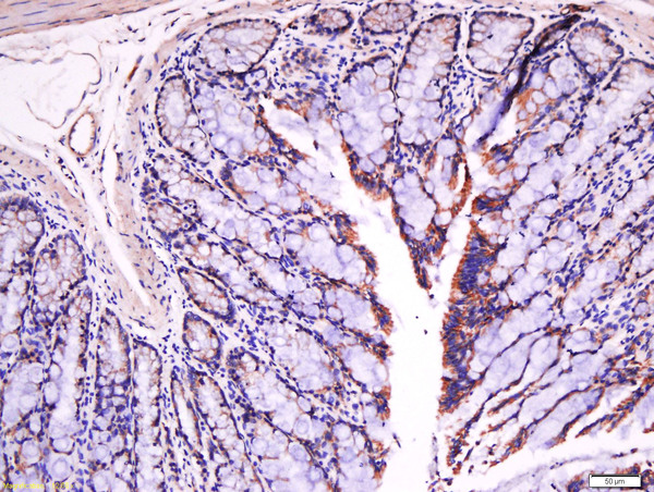Paraformaldehyde-fixed, paraffin embedded rat intestine tissue; Antigen retrieval by boiling in sodium citrate buffer(pH6) for 15min; Block endogenous peroxidase by 3% hydrogen peroxide for 30 minutes; Blocking buffer (normal goat serum) at 37°C for 20min; Antibody incubation with Rabbit Anti-Fibronectin Polyclonal Antibody, Unconjugated (bs-0666R) at 1:500 overnight at 4°C, followed by a conjugated secondary and DAB staining