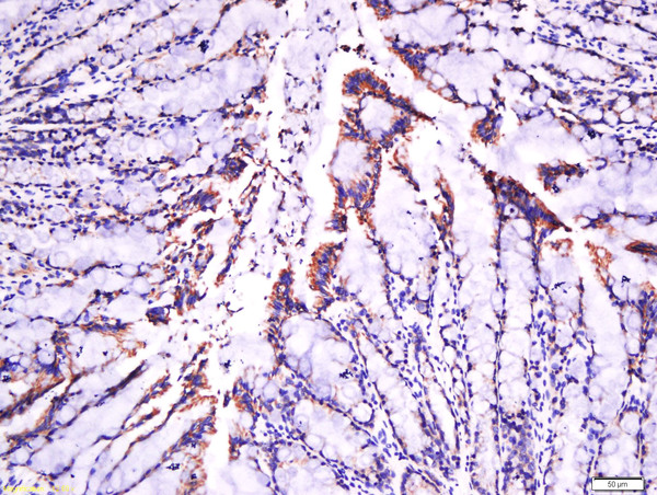 Paraformaldehyde-fixed, paraffin embedded rat intestine tissue; Antigen retrieval by boiling in sodium citrate buffer(pH6) for 15min; Block endogenous peroxidase by 3% hydrogen peroxide for 30 minutes; Blocking buffer (normal goat serum) at 37°C for 20min; Antibody incubation with Rabbit Anti-Laminin Polyclonal Antibody, Unconjugated (bs-0821R) at 1:500 overnight at 4°C, followed by a conjugated secondary and DAB staining