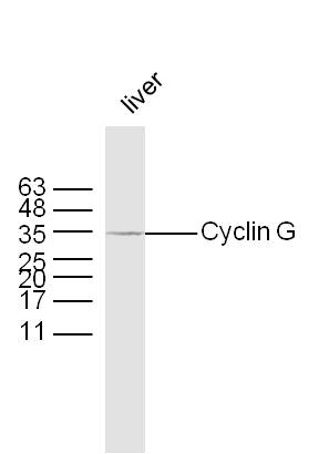 Mouse liver lysates probed with Rabbit Anti-Cyclin G Polyclonal Antibody, Unconjugated (bs-1389R) at 1:300 overnight at 4˚C. Followed by a conjugated secondary antibody for 90 min at 37˚C.