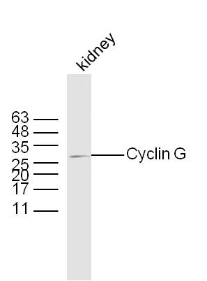 Mouse kidney lysates probed with Rabbit Anti-Cyclin G Polyclonal Antibody, Unconjugated (bs-1389R) at 1:300 overnight at 4˚C. Followed by a conjugated secondary antibody for 90 min at 37˚C.