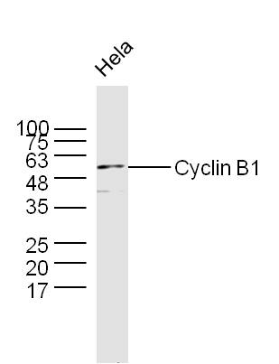 HeLa lysates probed with Anti \u2013(Name) Polyclonal Antibody, Unconjugated (Catalog #) at 1:300 overnight at 4˚C. Followed by a conjugated secondary antibody (Secondary Catalog #)  at 1:5000 for 90 min at 37˚C.