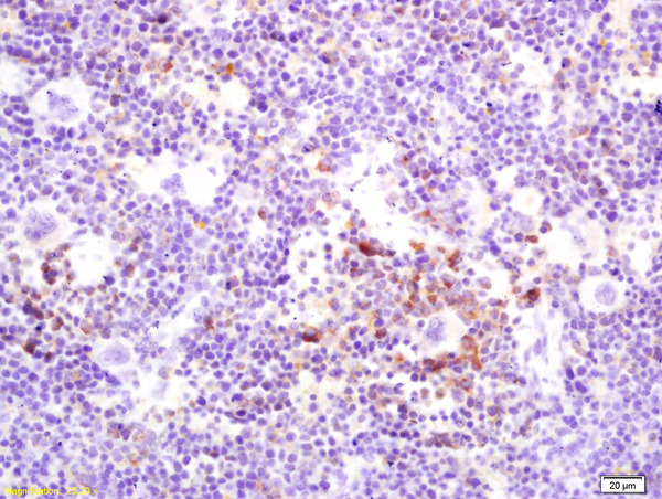 Formalin-fixed and paraffin embedded mouse spleen labeled with Rabbit Anti OPGL/RANKL/ODF Polyclonal Antibody, Unconjugated (bs-0747R) at 1:200 followed by conjugation to the secondary antibody and DAB staining
