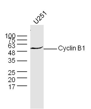 U251 lysates probed with Anti –(Name) Polyclonal Antibody, Unconjugated (Catalog #) at 1:300 overnight at 4˚C. Followed by a conjugated secondary antibody (Secondary Catalog #) at 1:5000 for 90 min at 37˚C.