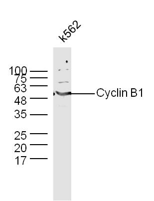 K562 lysates probed with Anti \u2013(Name) Polyclonal Antibody, Unconjugated (Catalog #) at 1:300 overnight at 4˚C. Followed by a conjugated secondary antibody (Secondary Catalog #)  at 1:5000 for 90 min at 37˚C.