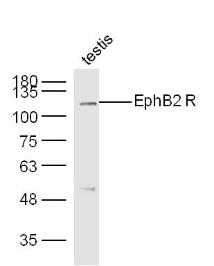 Mouse testis lysates probed with Rabbit Anti-EphB2 R Polyclonal Antibody, Unconjugated (bs-0247R) at 1:300 overnight at 4˚C. Followed by a conjugated secondary antibody for 90 min at 37˚C.