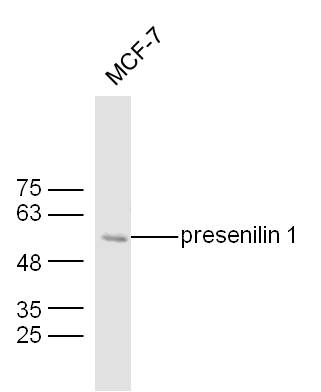MCF7 lysates probed with Mouse Anti-presenilin 1 Polyclonal Antibody, Unconjugated (bs-0025M) at 1:300 overnight at 4˚C. Followed by a conjugated secondary antibody for 90 min at 37˚C.