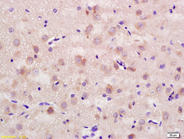 Formalin-fixed and paraffin embedded rat brain labeled with Rabbit Anti CD56/NCAM1 Polyclonal Antibody, Unconjugated (bs-0805R) at 1:200 followed by conjugation to the secondary antibody and DAB staining