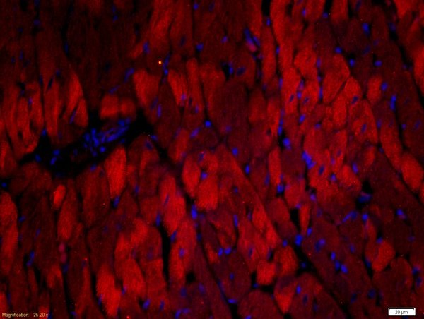 Paraformaldehyde-fixed, paraffin embedded rat heart; Antigen retrieval by boiling in sodium citrate buffer (pH6) for 15min; Block endogenous peroxidase by 3% hydrogen peroxide for 30 minutes; Blocking buffer (normal goat serum) at 37°C for 20min; Antibody incubation with Rabbit Anti-Troponin T Polyclonal Antibody, Unconjugated (bs-10648R) at 1:500 overnight at 4°C, followed by a conjugated secondary Goat Anti-Rabbit IgG, Cy3 conjugated(bs-0295G-Cy3)used at 1:200 dilution for 40 minutes at 37°C. DAPI(5ug/ml,blue) was used to stain the cell nuclei