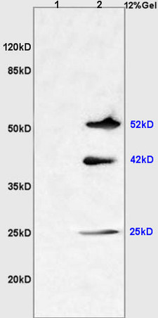 L1 mouse liver lysates L2 mouse brain lysates probed with Anti NGX6/C9orf127 Polyclonal Antibody, Unconjugated (bs-1065R) at 1:200 overnight at 4˚C. Followed by conjugation to secondary antibody (bs-0295G-HRP) at 1:3000 for 90 min at 37˚C. Predicted band 52kD. Observed band size:52kD,42kD,25kD\n