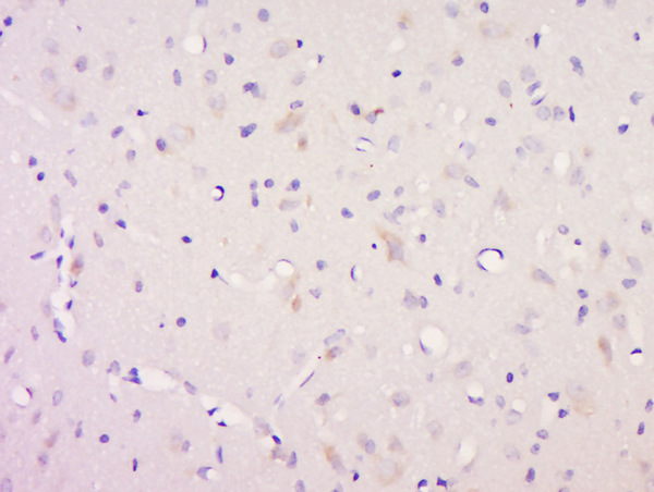 Paraformaldehyde-fixed, paraffin embedded rat brain; Antigen retrieval by boiling in sodium citrate buffer (pH6) for 15min; Block endogenous peroxidase by 3% hydrogen peroxide for 30 minutes; Blocking buffer (normal goat serum) at 37°C for 20min; Antibody incubation with Rabbit Anti-Neurotrophin 3 Polyclonal Antibody, Unconjugated (bs-0160R ) at 1:200 overnight at 4°C, followed by a conjugated secondary for 90 minutes and DAB staining