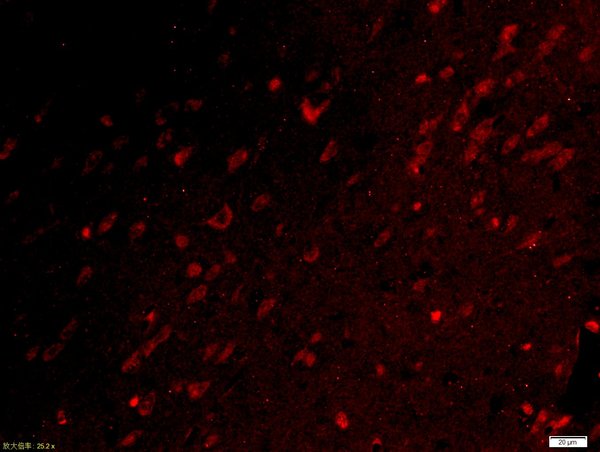 Paraformaldehyde-fixed, paraffin embedded rat brain tissue; Antigen retrieval by boiling in sodium citrate buffer(pH6) for 15min; Block endogenous peroxidase by 3% hydrogen peroxide for 30 minutes; Blocking buffer (normal goat serum) at 37°C for 20min; Antibody incubation with Rabbit Anti-UBE2Q1 Polyclonal Antibody, Unconjugated (bs-8383R) at 1:500 overnight at 4°C, followed by a conjugated secondary and DAPI staining