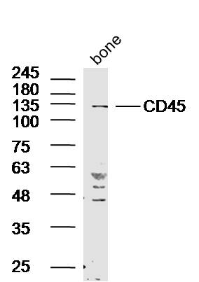 Rat bone lysates probed with Rabbit Anti-CD45 Polyclonal Antibody, Unconjugated (bs-4819R) at 1:300 in 4˚C overnight. Followed by conjugation to secondary antibody (bs-0295G-HRP) at 1:5000 for 90min at 37˚C.