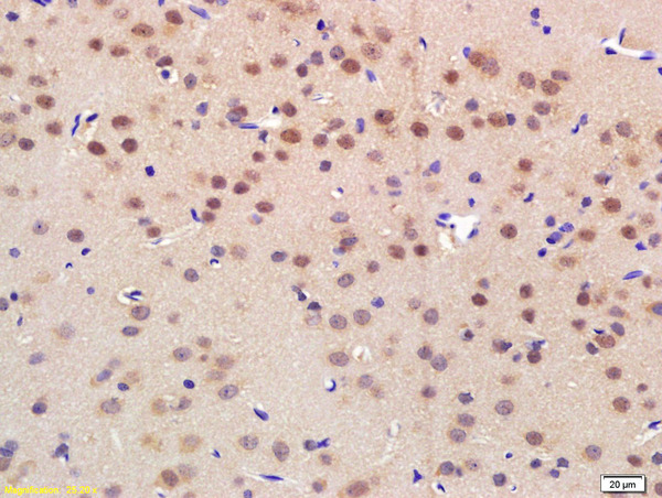 Formalin-fixed and paraffin embedded rat brain labeled with Rabbit Anti NRF-1 Polyclonal Antibody, Unconjugated (bs-1342R) at 1:200 followed by conjugation to the secondary antibody and DAB staining