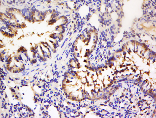 Paraformaldehyde-fixed, paraffin embedded rat lung; Antigen retrieval by boiling in sodium citrate buffer (pH6) for 15min; Block endogenous peroxidase by 3% hydrogen peroxide for 30 minutes; Blocking buffer (normal goat serum) at 37°C for 20min; Antibody incubation with Rabbit Anti-MSK1 (Ser360) Polyclonal Antibody, Unconjugated (bs-3281R) at 1:200 overnight at 4°C, followed by a conjugated secondary for 90 minutes and DAB staining.