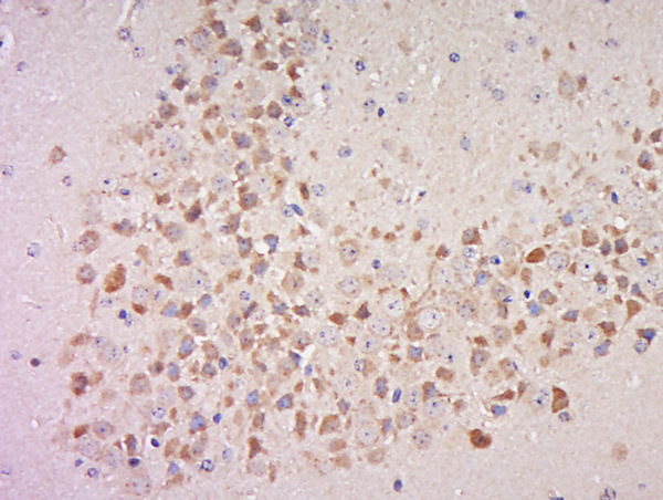 Paraformaldehyde-fixed, paraffin embedded mouse brain; Antigen retrieval by boiling in sodium citrate buffer (pH6) for 15min; Block endogenous peroxidase by 3% hydrogen peroxide for 30 minutes; Blocking buffer (normal goat serum) at 37°C for 20min; Antibody incubation with Rabbit Anti-MSK1 (Ser360) Polyclonal Antibody, Unconjugated (bs-3281R) at 1:500 overnight at 4°C, followed by a conjugated secondary for 90 minutes and DAB staining.