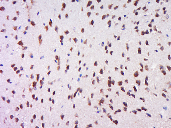 Paraformaldehyde-fixed, paraffin embedded rat brain; Antigen retrieval by boiling in sodium citrate buffer (pH6) for 15min; Block endogenous peroxidase by 3% hydrogen peroxide for 30 minutes; Blocking buffer (normal goat serum) at 37°C for 20min; Antibody incubation with Rabbit Anti-MSK1 (Ser212) Polyclonal Antibody, Unconjugated (bs-3282R) at 1:500 overnight at 4°C, followed by a conjugated secondary for 90 minutes and DAB staining.