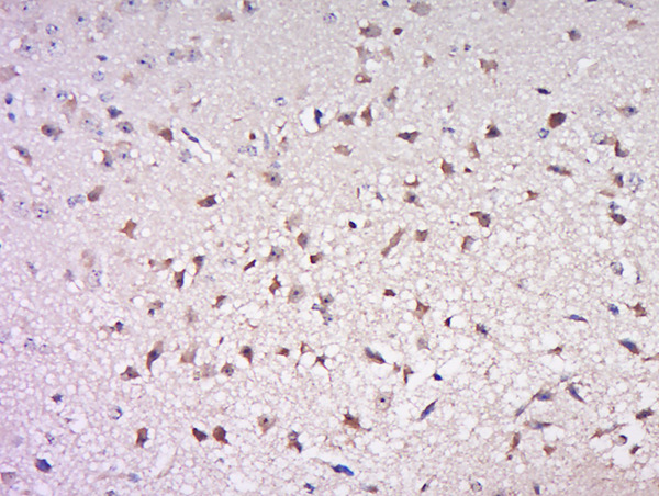 Paraformaldehyde-fixed, paraffin embedded mouse brain; Antigen retrieval by boiling in sodium citrate buffer (pH6) for 15min; Block endogenous peroxidase by 3% hydrogen peroxide for 30 minutes; Blocking buffer (normal goat serum) at 37°C for 20min; Antibody incubation with Rabbit Anti-Cdc25B (Ser186) Polyclonal Antibody, Unconjugated (bs-5244R) at 1:500 overnight at 4°C, followed by a conjugated secondary for 90 minutes and DAB staining. Paraformaldehyde-fixed, paraffin embedded mouse brain; Antigen retrieval by boiling in sodium citrate buffer (pH6) for 15min; Block endogenous peroxidase by 3% hydrogen peroxide for 30 minutes; Blocking buffer (normal goat serum) at 37°C for 20min; Antibody incubation with Rabbit Anti-Cdc25B (Ser186) Polyclonal Antibody, Unconjugated (bs-5244R) at 1:500 overnight at 4°C, followed by a conjugated secondary for 90 minutes and DAB staining.