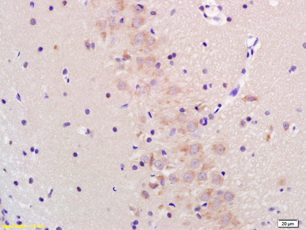 Formalin-fixed and paraffin embedded rat brain labeled with Anti-GADD153 Polyclonal Antibody, Unconjugated (bs-1361R) at 1:200 followed by conjugation to the secondary antibody and DAB staining.