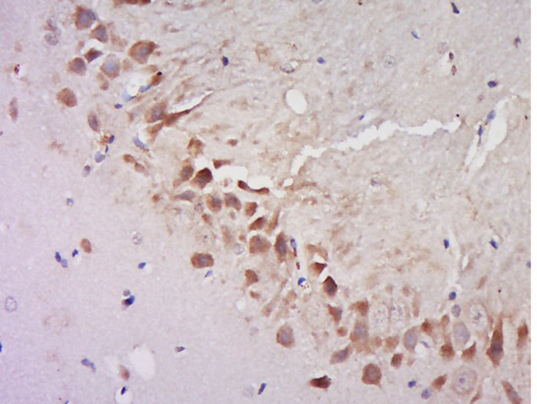 Paraformaldehyde-fixed, paraffin embedded rat brain; Antigen retrieval by boiling in sodium citrate buffer (pH6) for 15min; Block endogenous peroxidase by 3% hydrogen peroxide for 30 minutes; Blocking buffer (normal goat serum) at 37°C for 20min; Antibody incubation with Rabbit Anti-AGFG2 Polyclonal Antibody, Unconjugated (bs-8073R) at 1:200 overnight at 4°C, followed by a conjugated secondary for 90 minutes and DAB staining.