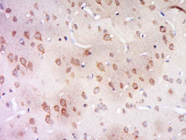 Paraformaldehyde-fixed, paraffin embedded rat brain; Antigen retrieval by boiling in sodium citrate buffer (pH6) for 15min; Block endogenous peroxidase by 3% hydrogen peroxide for 30 minutes; Blocking buffer (normal goat serum) at 37°C for 20min; Antibody incubation with Rabbit Anti-CCDC94 Polyclonal Antibody, Unconjugated (bs-8081R) at 1:200 overnight at 4°C, followed by a conjugated secondary for 90 minutes and DAB staining.