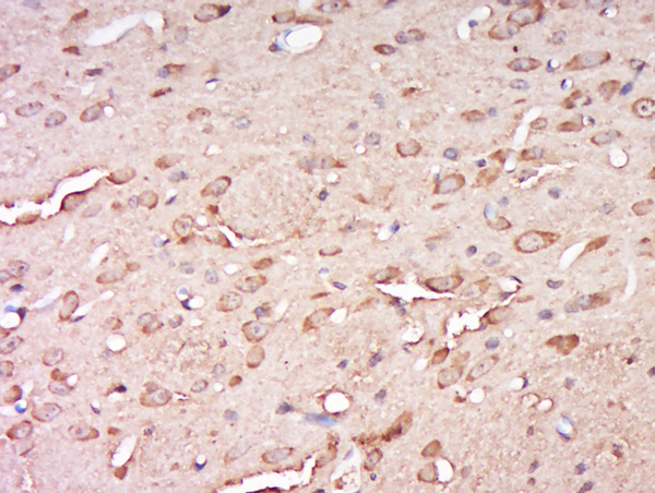 Paraformaldehyde-fixed, paraffin embedded rat brain; Antigen retrieval by boiling in sodium citrate buffer (pH6) for 15min; Block endogenous peroxidase by 3% hydrogen peroxide for 30 minutes; Blocking buffer (normal goat serum) at 37°C for 20min; Antibody incubation with Rabbit Anti-CCDC82 Polyclonal Antibody, Unconjugated (bs-8085R) at 1:500 overnight at 4°C, followed by a conjugated secondary for 90 minutes and DAB staining.
