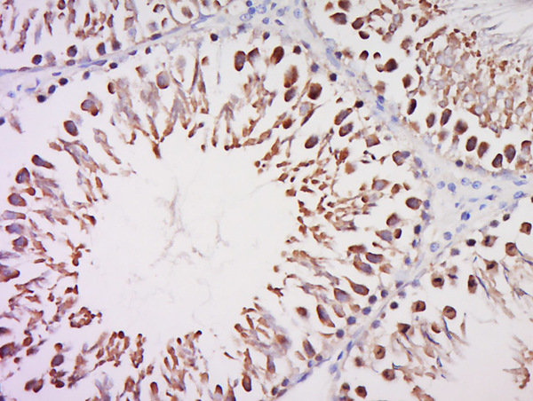 Paraformaldehyde-fixed, paraffin embedded rat testis; Antigen retrieval by boiling in sodium citrate buffer (pH6) for 15min; Block endogenous peroxidase by 3% hydrogen peroxide for 30 minutes; Blocking buffer (normal goat serum) at 37°C for 20min; Antibody incubation with Rabbit Anti-TFIID/TATA binding protein TBP Polyclonal Antibody, Unconjugated (bs-11766R) at 1:200 overnight at 4°C, followed by a conjugated secondary for 90 minutes and DAB staining.