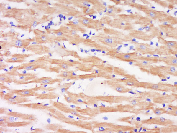 Paraformaldehyde-fixed, paraffin embedded rat heart; Antigen retrieval by boiling in sodium citrate buffer (pH6) for 15min; Block endogenous peroxidase by 3% hydrogen peroxide for 30 minutes; Blocking buffer (normal goat serum) at 37°C for 20min; Antibody incubation with Rabbit Anti-MEK6 (Ser202) Polyclonal Antibody, Unconjugated (bs-3276R) at 1:500 overnight at 4°C, followed by a conjugated secondary for 90 minutes and DAB staining.