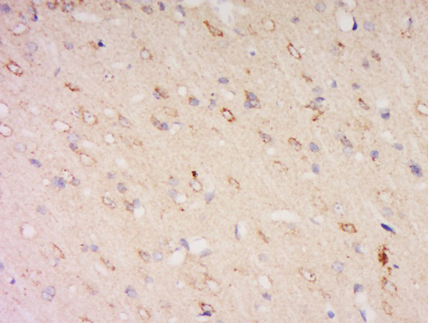 Paraformaldehyde-fixed, paraffin embedded rat brain; Antigen retrieval by boiling in sodium citrate buffer (pH6) for 15min; Block endogenous peroxidase by 3% hydrogen peroxide for 30 minutes; Blocking buffer (normal goat serum) at 37°C for 20min; Antibody incubation with Rabbit Anti-CLN8 Polyclonal Antibody, Unconjugated (bs-11715R) at 1:500 overnight at 4°C, followed by a conjugated secondary for 90 minutes and DAB staining.