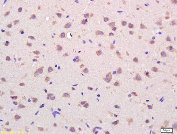 Formalin-fixed and paraffin embedded rat brain labeled with  Rabbit Anti VDAC Polyclonal Antibody, Unconjugated (bs-1461R) at 1:200 followed by conjugation to the secondary antibody and DAB staining