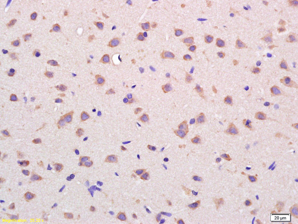 Formalin-fixed and paraffin embedded rat brain labeled with Rabbit Anti VDAC Polyclonal Antibody, Unconjugated (bs-1461R) at 1:200 followed by conjugation to the secondary antibody and DAB staining